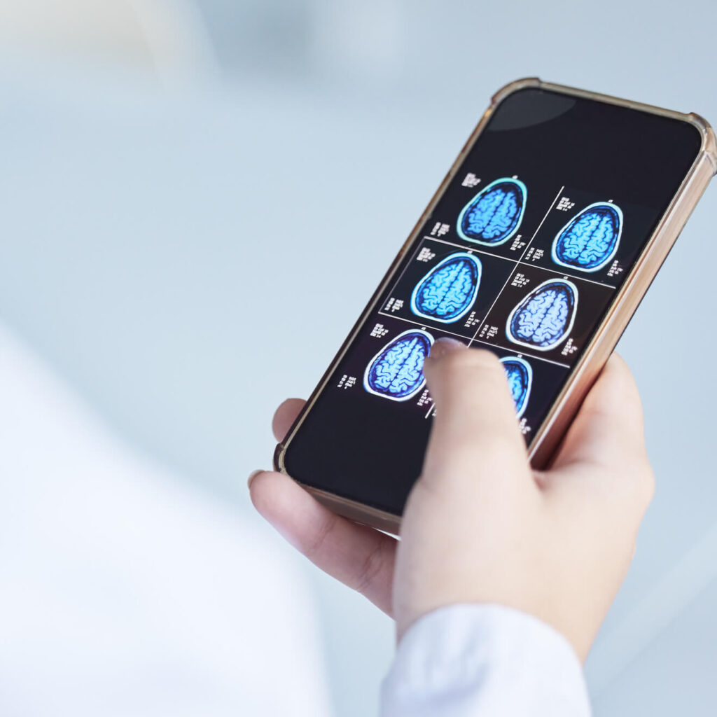Can your cell phone cause brain cancer?